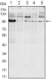 IRE1 alpha Antibody in Western Blot (WB)