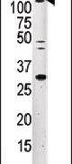 ERN2 Antibody in Western Blot (WB)