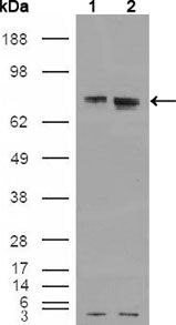Estrogen Receptor alpha Antibody in Western Blot (WB)