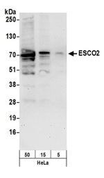 ESCO2 Polyclonal Antibody