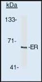 Estrogen Receptor alpha Monoclonal Antibody (TE111.5D11)