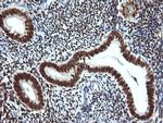 ESR1 Antibody in Immunohistochemistry (Paraffin) (IHC (P))