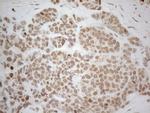 ESR1 Antibody in Immunohistochemistry (Paraffin) (IHC (P))