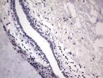ESR1 Antibody in Immunohistochemistry (Paraffin) (IHC (P))