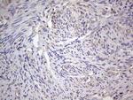 ESR1 Antibody in Immunohistochemistry (Paraffin) (IHC (P))
