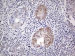 ESR1 Antibody in Immunohistochemistry (Paraffin) (IHC (P))