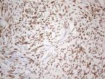 ESR1 Antibody in Immunohistochemistry (Paraffin) (IHC (P))