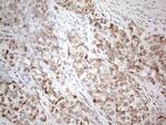 ESR1 Antibody in Immunohistochemistry (Paraffin) (IHC (P))
