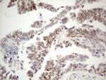 ESR1 Antibody in Immunohistochemistry (Paraffin) (IHC (P))