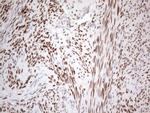 ESR1 Antibody in Immunohistochemistry (Paraffin) (IHC (P))