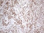 ESR1 Antibody in Immunohistochemistry (Paraffin) (IHC (P))