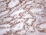 ESR1 Antibody in Immunohistochemistry (Paraffin) (IHC (P))