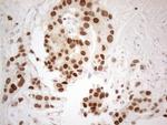 ESR1 Antibody in Immunohistochemistry (Paraffin) (IHC (P))