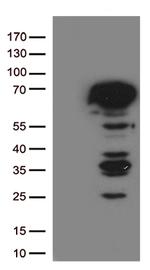 ESR1 Antibody in Western Blot (WB)