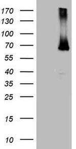 ESR1 Antibody in Western Blot (WB)