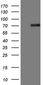 ESR1 Antibody in Western Blot (WB)