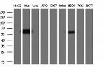 ESR1 Antibody in Western Blot (WB)