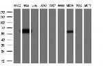 ESR1 Antibody in Western Blot (WB)