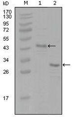 Estrogen Receptor alpha Monoclonal Antibody (8H9A10)