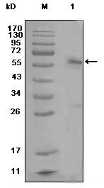 Estrogen Receptor alpha Antibody in Western Blot (WB)