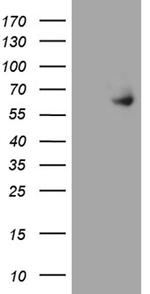 ESR2 Antibody in Western Blot (WB)