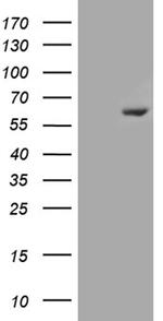 ESR2 Antibody in Western Blot (WB)