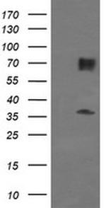 ESRRG Antibody in Western Blot (WB)