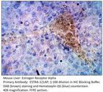 Estrogen Receptor alpha Antibody in Immunohistochemistry (IHC)