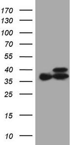 ETFA Antibody in Western Blot (WB)