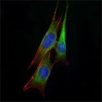ETS1 Monoclonal Antibody (8A8)
