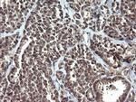 ETS2 Antibody in Immunohistochemistry (Paraffin) (IHC (P))