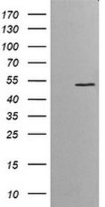 ETS2 Antibody in Western Blot (WB)