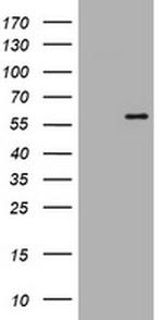 ETS2 Antibody in Western Blot (WB)