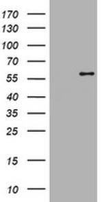 ETS2 Antibody in Western Blot (WB)