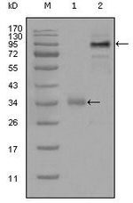 ETV1 Monoclonal Antibody (1C8B6)