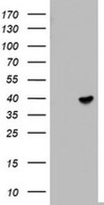ETV7 Antibody in Western Blot (WB)