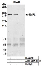 EVPL Polyclonal Antibody