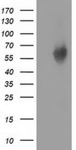 EXD1 Antibody in Western Blot (WB)