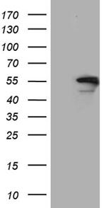 EXOC4 Antibody in Western Blot (WB)
