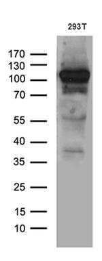 EXOC4 Antibody in Western Blot (WB)