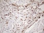 EXOSC1 Antibody in Immunohistochemistry (Paraffin) (IHC (P))