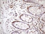 EXOSC1 Antibody in Immunohistochemistry (Paraffin) (IHC (P))