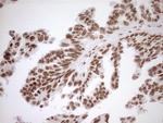 EXOSC1 Antibody in Immunohistochemistry (Paraffin) (IHC (P))