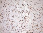 EXOSC1 Antibody in Immunohistochemistry (Paraffin) (IHC (P))
