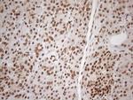 EXOSC1 Antibody in Immunohistochemistry (Paraffin) (IHC (P))