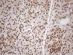 EXOSC1 Antibody in Immunohistochemistry (Paraffin) (IHC (P))
