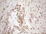 EXOSC1 Antibody in Immunohistochemistry (Paraffin) (IHC (P))