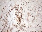 EXOSC1 Antibody in Immunohistochemistry (Paraffin) (IHC (P))