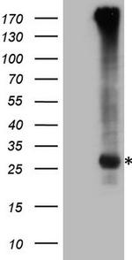 EXOSC1 Antibody in Western Blot (WB)