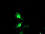 EXOSC7 Monoclonal Antibody (OTI1G8), TrueMAB™